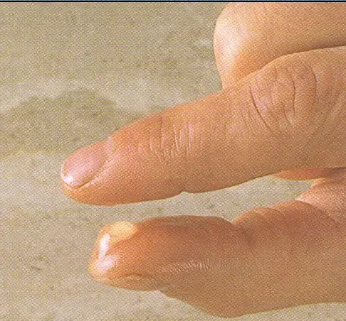 Pehmeä kuula-aste sokeriliemi 116-118 astetta, muodostaa pehmeän pallon